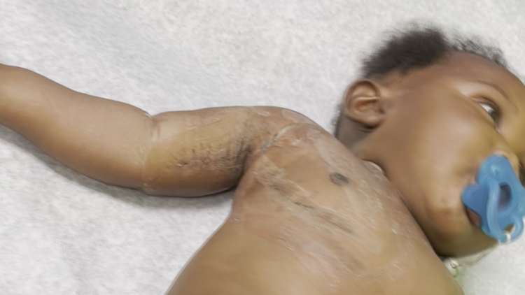 Tampa mom calls for stronger legislation after uninsured midwife injures child — WTSP 10 Tampa Bay, Riverview Community news